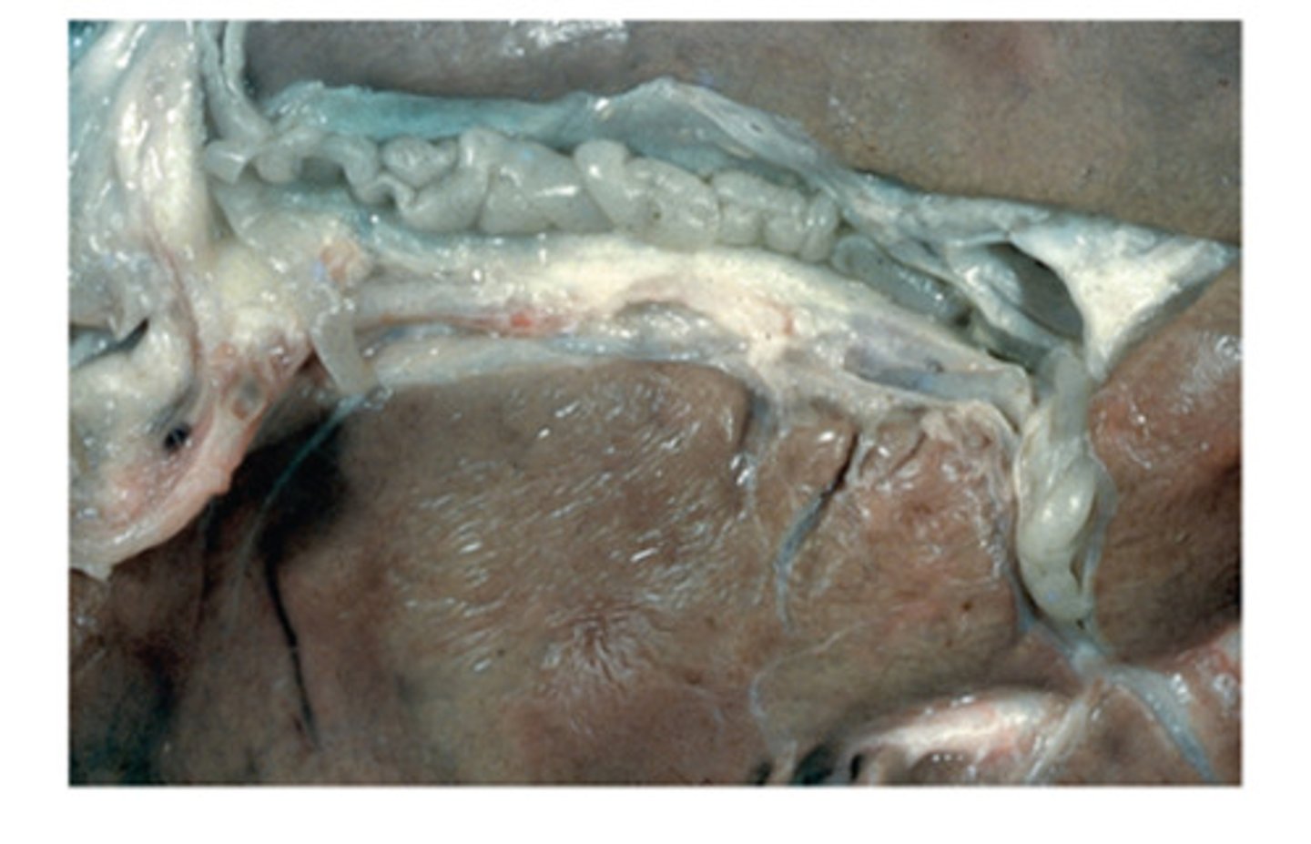 <p>Thysanosoma actinides is an unusual tapeworm in that adults do not infect the intestines or stomach of the host. Instead they infect</p>
