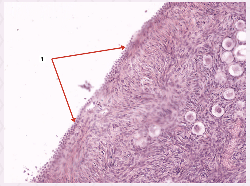 <p>Identify the structure labeled as 1.</p>