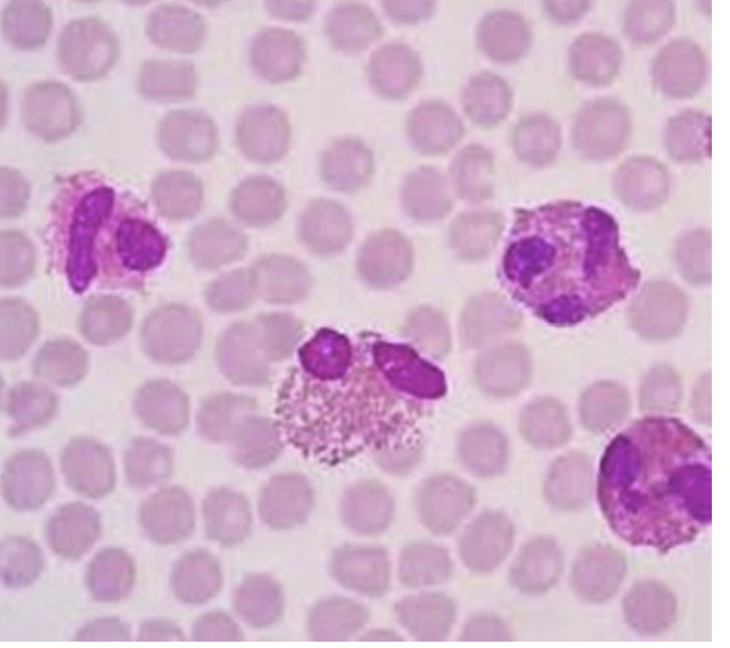 <p>Eosinophil is part of the innate immunity </p><ul><li><p>Nuclweus is bilobed (2 lobes) or oval-shaped</p></li><li><p>Granules are red-orange in color</p></li></ul><p>Functions include:</p><ul><li><p>Phagocytosis</p></li><li><p>Neutralizing allergy-related chemicals</p><ul><li><p>releases chemical to help with allergy </p></li></ul></li><li><p>Killing parasites</p></li><li><p>Releasing cytokines (chemical messengers to guide immune response)</p></li></ul><p></p>