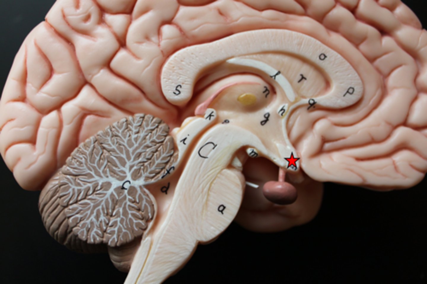 <p>located near the base of the brain; point where some the fibers in the optic nerve crossover to the other side of the brain</p>