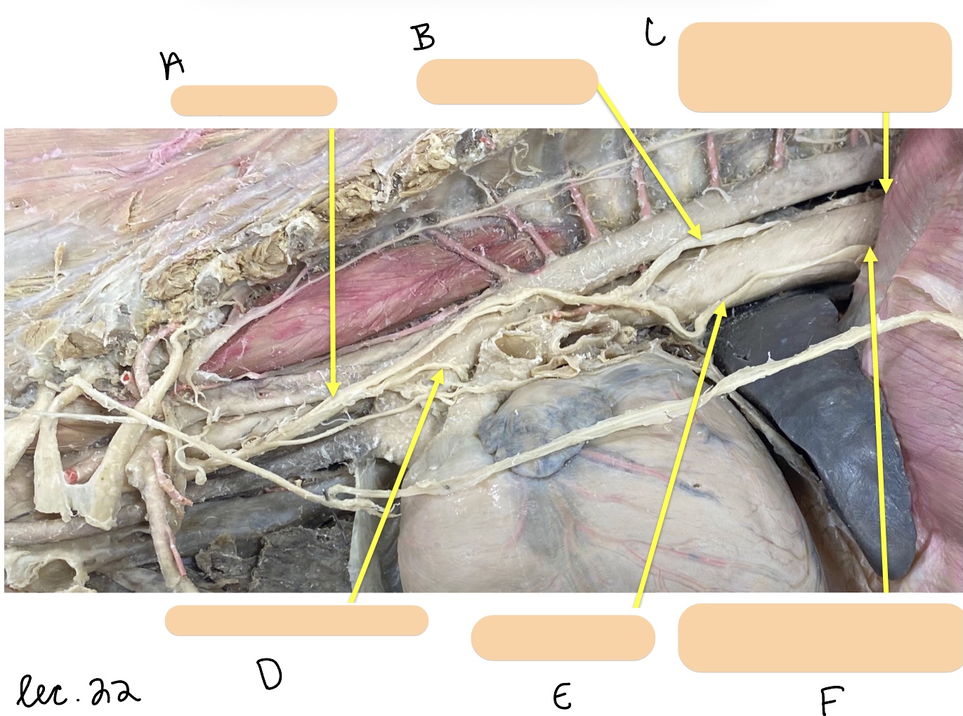 <p>Name the structure(s) represented by&nbsp;a, b, and c.</p>
