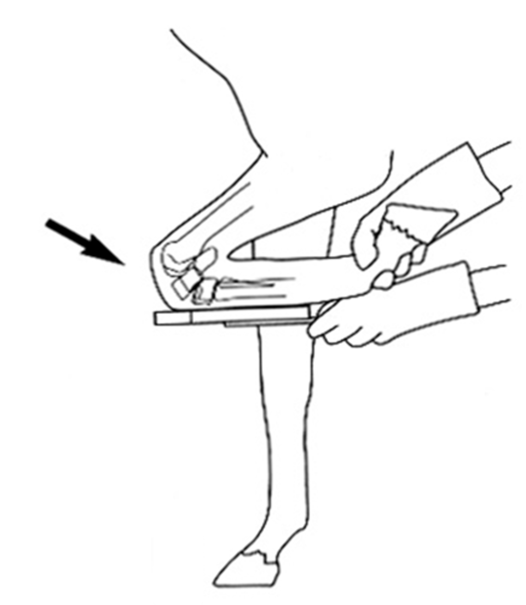 <p>What view is being taken?</p>