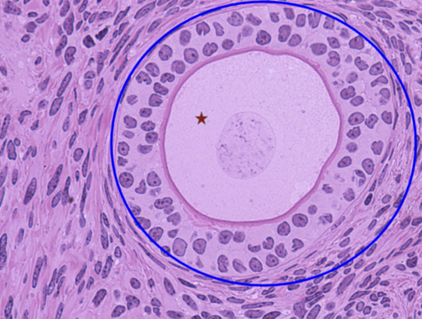 <p>What is the blue circle?</p>