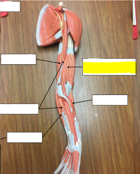 <p>what nerve is highlighted in yellow?</p>