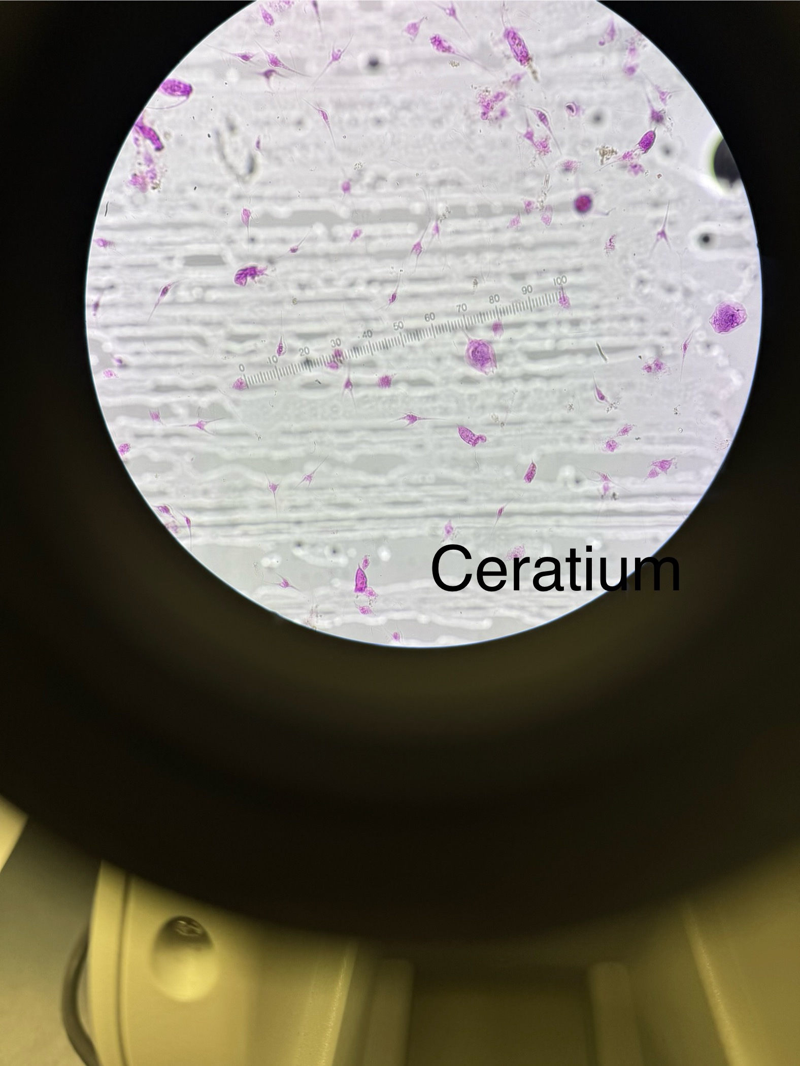 <p>Domain: Eukarya</p><p style="text-align: start">Kingdom: Protista</p><p style="text-align: start">Phylum: Dinophyta</p><p style="text-align: start">Genus: Ceratium</p><p style="text-align: start">Cell walls made of cellulose</p><p style="text-align: start">Mostly marine organisms with many being bioluminescent</p><p style="text-align: start">Common name “dinoflagellates”</p><p style="text-align: start">Harmless for most however some produce Neurotoxins that cause paralytic shellfish poisoning; Saxitoxin Is the pathogen made by Dinophyta Causing paralysis and death; “ Red tide”</p>