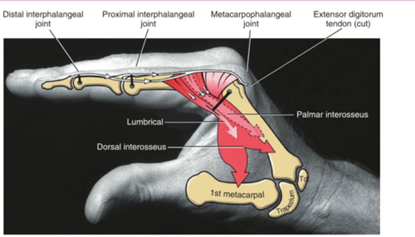 <p>1. What position is this hand in?</p><p>2. Which muscles are have more spasticity?</p>