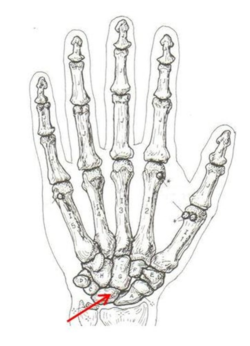 <p>ID bone</p>