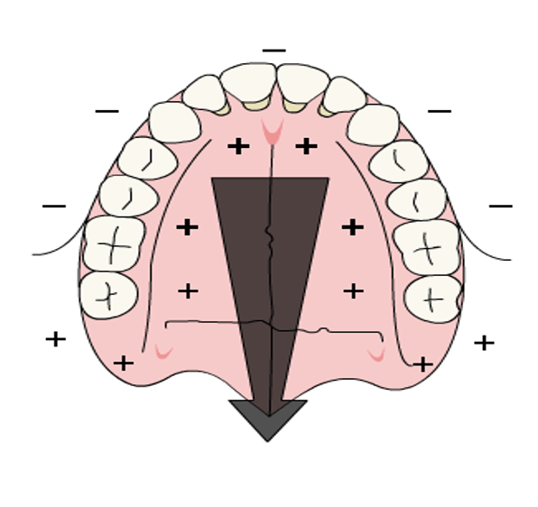<p>outline the growth pattern of the maxilla </p>