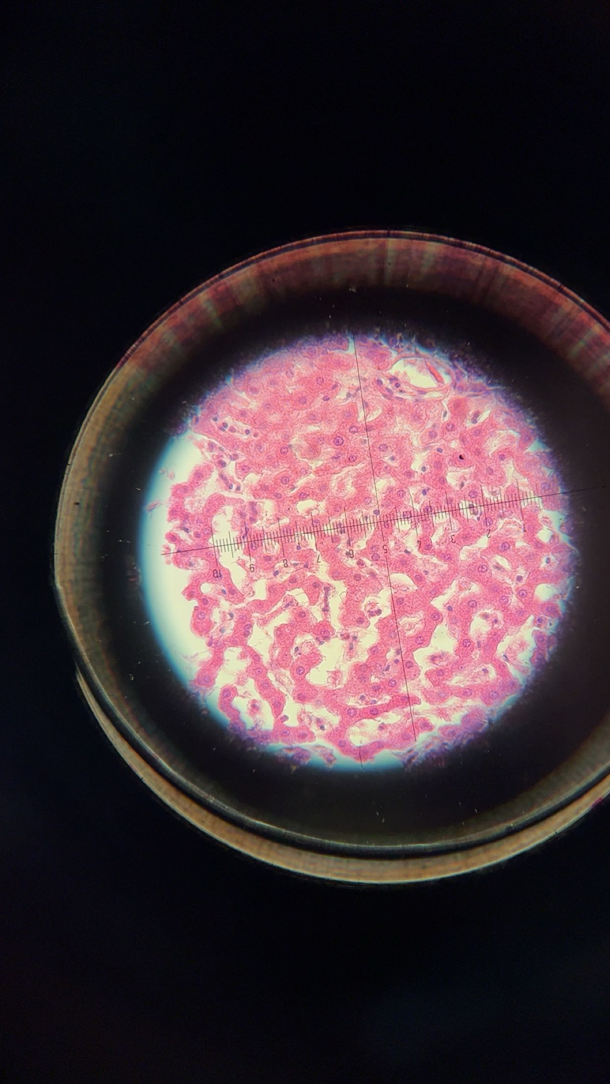 <p><em>Schistosoma mansoni </em>liver granuloma</p>