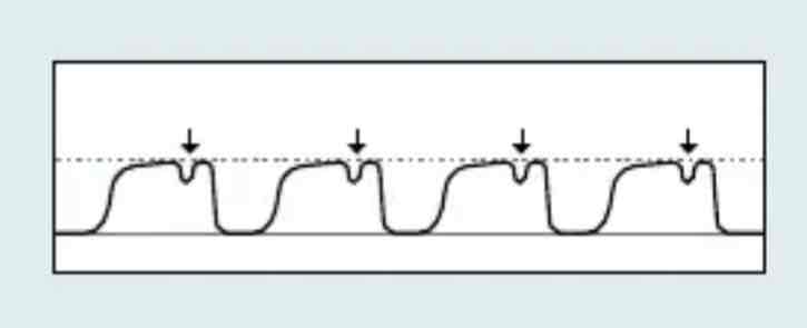 <p>which Capnography waveform is this</p>