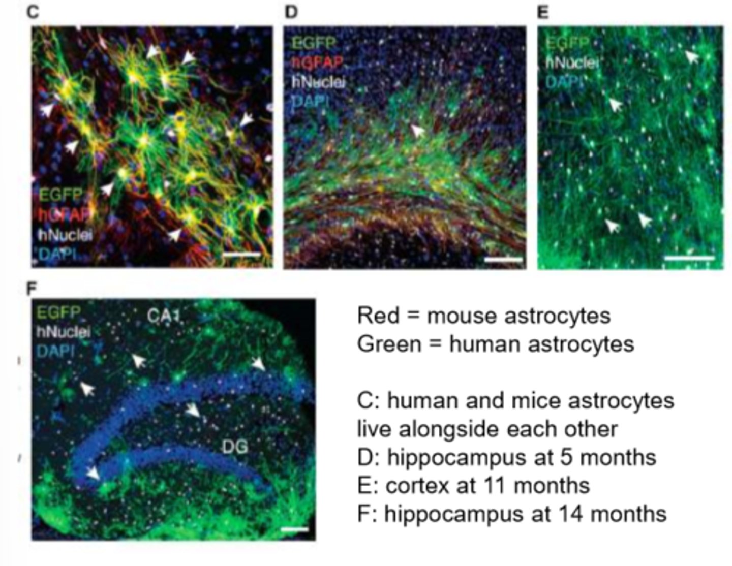<p>Astrocytes as Key Players in Human Intelligence:</p><p>- Astrocytes are star-shaped glial cells that outnumber neurons in the brain and play a critical role in supporting neural activity.</p><p>- Human astrocytes are larger and more complex than those in rodents, with more fibers and connections, contributing to the greater processing power of the human brain.</p><p>- When human astrocytes were transplanted into mice, the mice demonstrated enhanced cognitive abilities, such as improved learning and memory.</p><p>Glial Cells and Mental Health</p><p>- Astrocytes regulate synaptic activity, neurotransmitter balance, and brain plasticity, meaning they are essential for healthy brain function and mental well-being.</p><p>- Dysfunction in astrocytes has been linked to neurological and psychiatric disorders, including schizophrenia, depression, and neurodegenerative diseases like Alzheimer’s.</p><p>- The study of glial cells may open up new therapeutic avenues for treating mental health conditions.</p><p>Evolutionary Differences Between Humans and Rodents</p><p>- Compared to rodents, human astrocytes are more intricate, with more connections per neuron, which enhances information processing and cognitive flexibility.</p><p>-Rodents have less complex astrocytes with fewer fibers, which may explain why their cognitive abilities are more limited compared to humans.</p><p>Potential for Future Research and Therapy</p><p>- Understanding glial cell function can reshape how we approach brain disorders by targeting astrocytes as potential therapeutic agents.</p><p>- Research on glial transplantation (introducing human glia into animal models) may help develop treatments for cognitive and psychiatric disorders.</p>