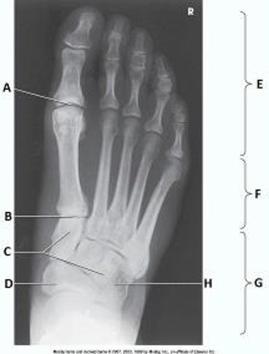 <p>Letter H in the image below labels the:</p><p>navicular</p><p>cuboid</p><p>talus</p><p>lateral cuneiform</p>