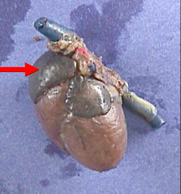 <p>receive oxygen poor blood and pumps it into the right ventricle</p>