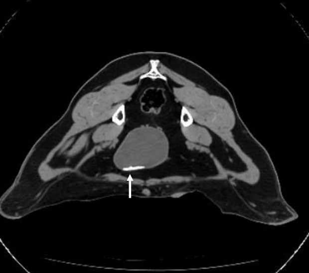 <p>picks up stones, umbilical issues in calves/small ruminants (usually not cost effective)</p><p></p><p>CT scan of goat with Ca-carbonate stones in bladder</p>