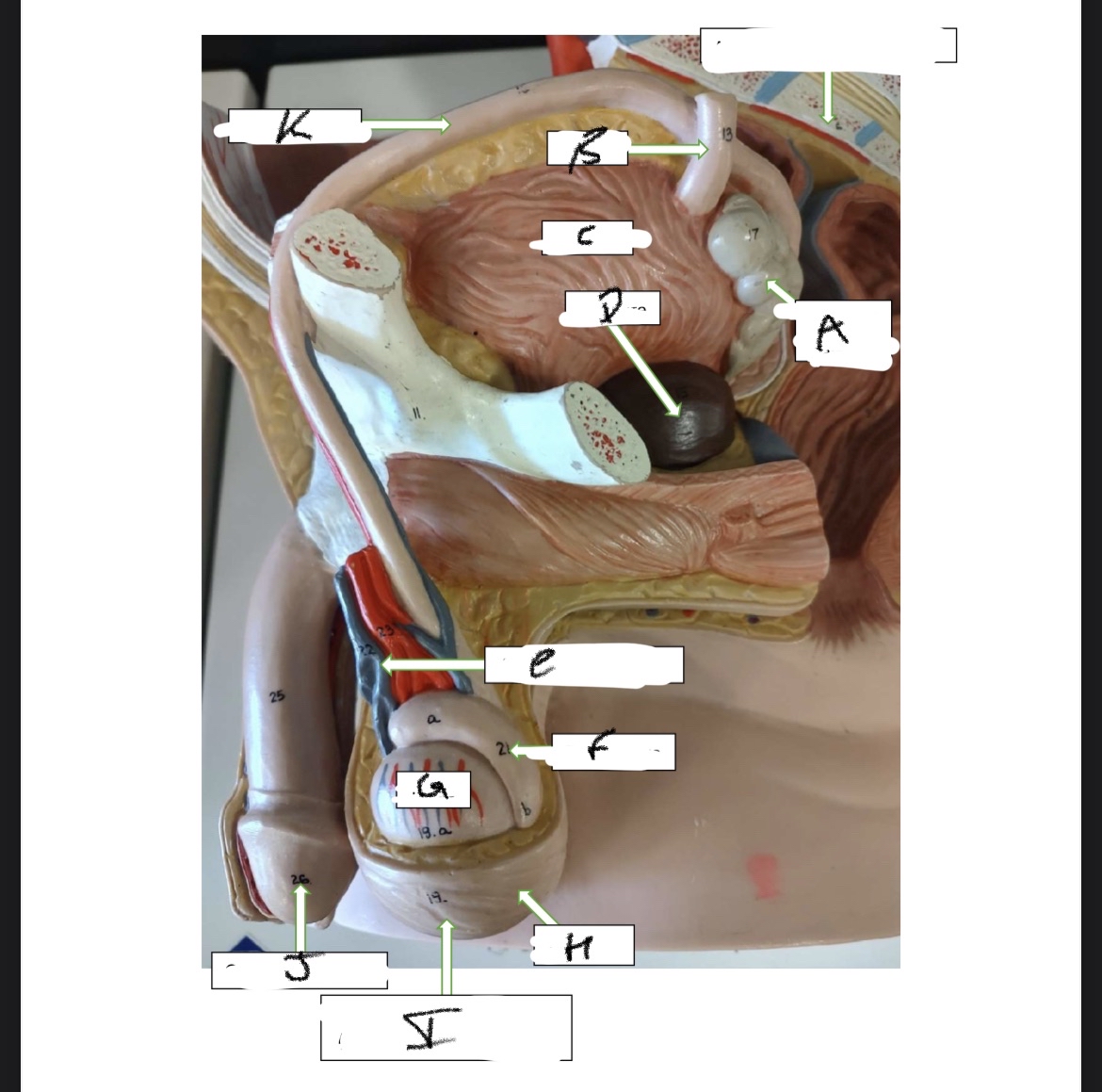 <p>What is structure C</p>