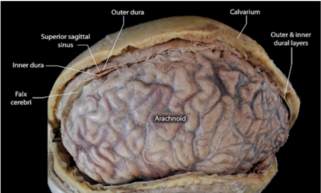 <p>ARACHNOID MATER</p>
