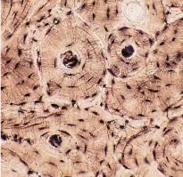 <p>Bone Tissue</p>