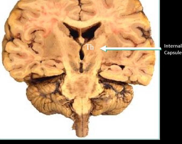 <p>internal capsule </p>