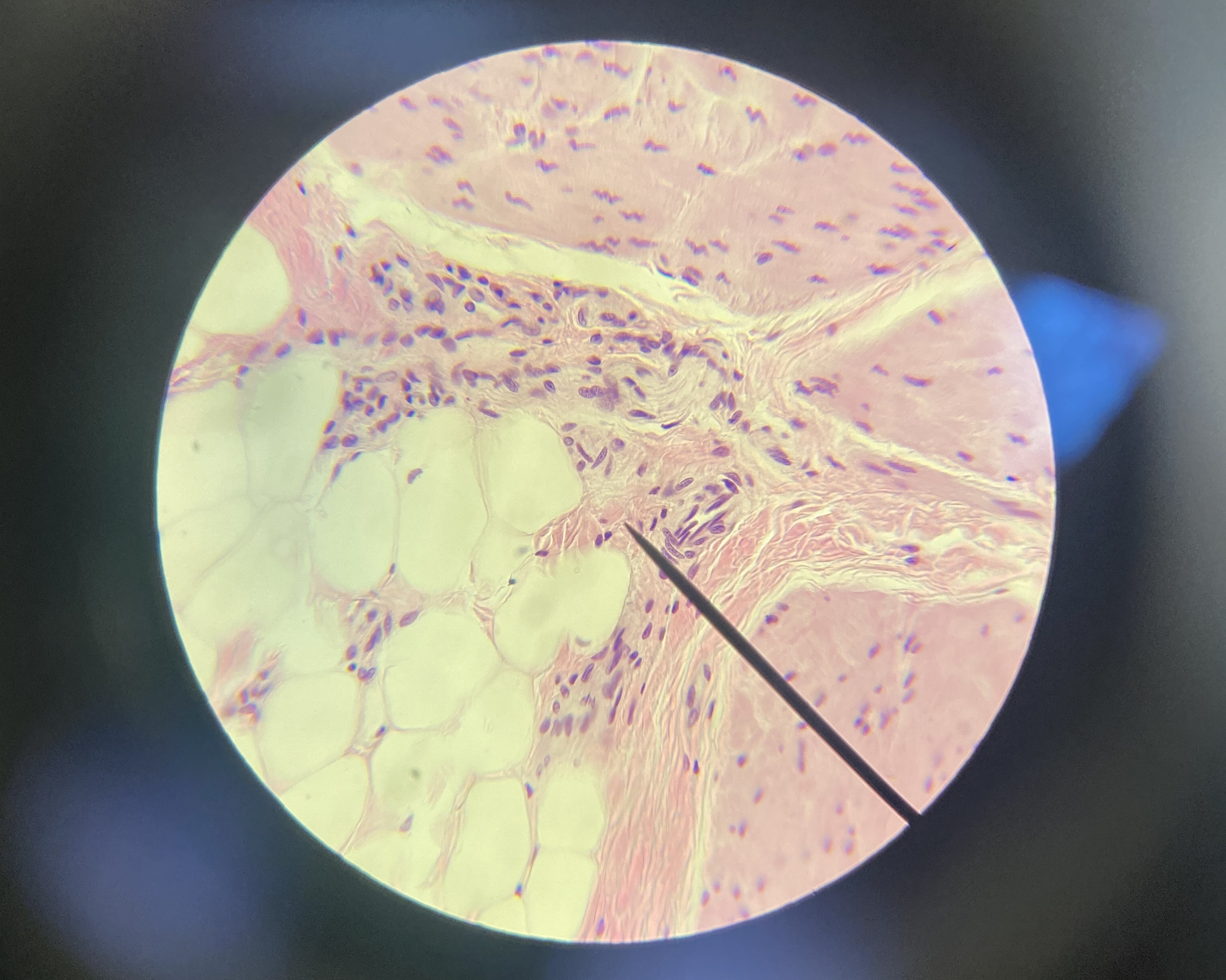 <p>transitional epithelium</p>