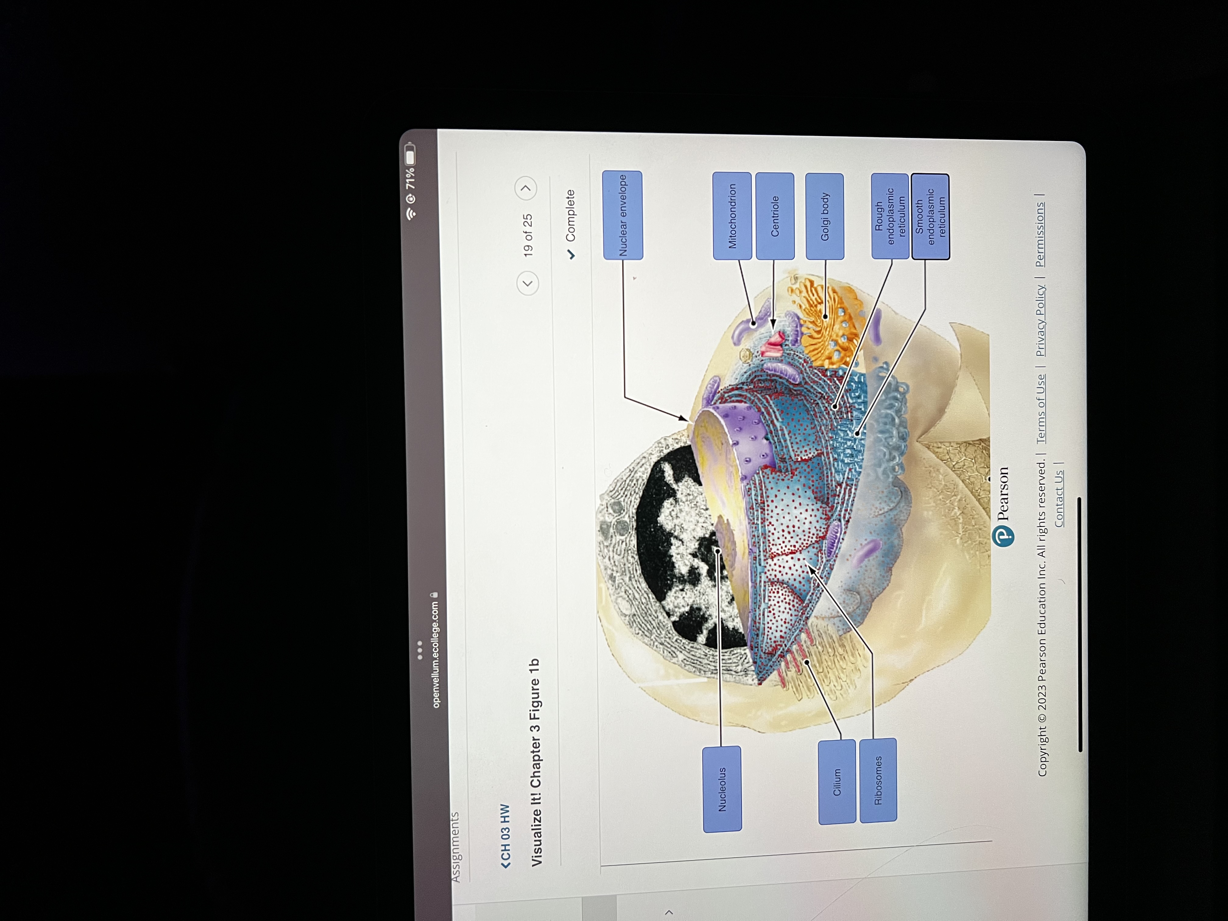 bottom (cytoskeleton) 