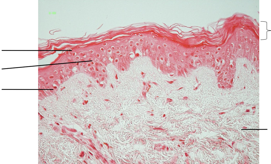 <p>Label strata of epidermis</p>