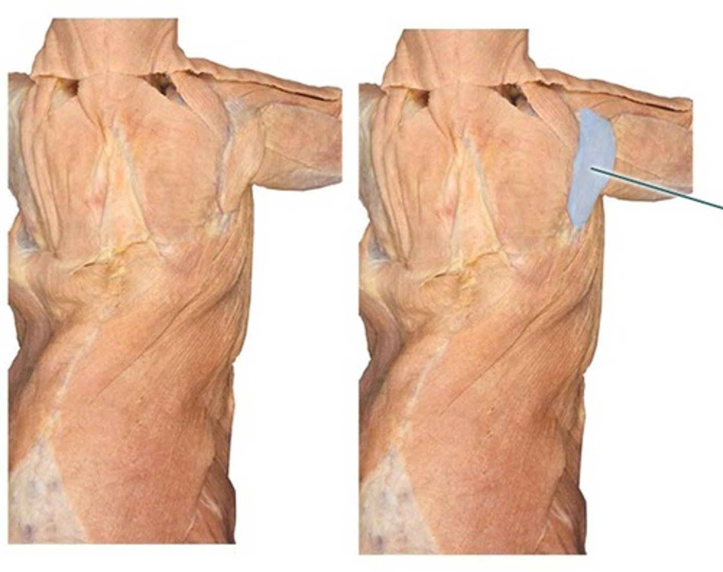 <p>name this muscle</p>