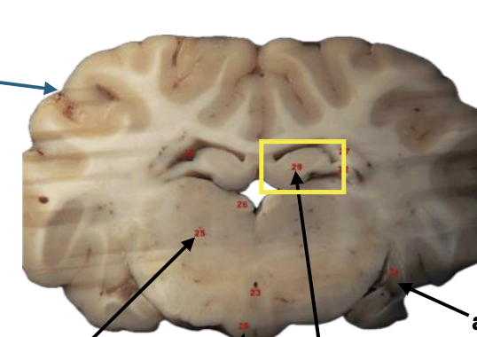 <p>What is this highlighted figure?</p>