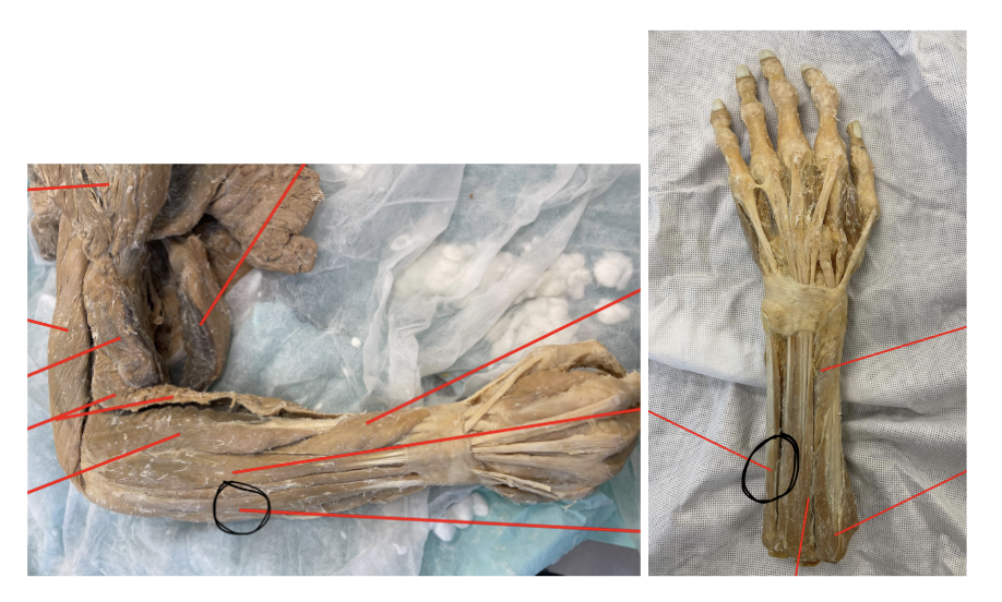 <p>what muscle do the marked images represent?</p>