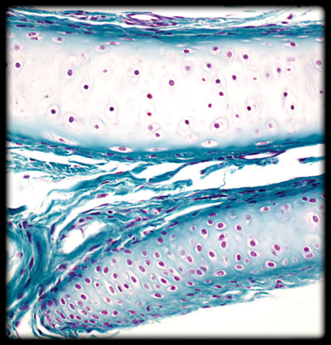 <p>- Glassy, smooth appearance due to the fine collagen fibers. - - Chondrocytes (cartilage cells) are visible in lacunae (small spaces).</p><p>- Appears as a smooth, clear matrix with scattered cells under the microscope.</p><p>- Found in the nose, trachea, and at the ends of long bones.</p>