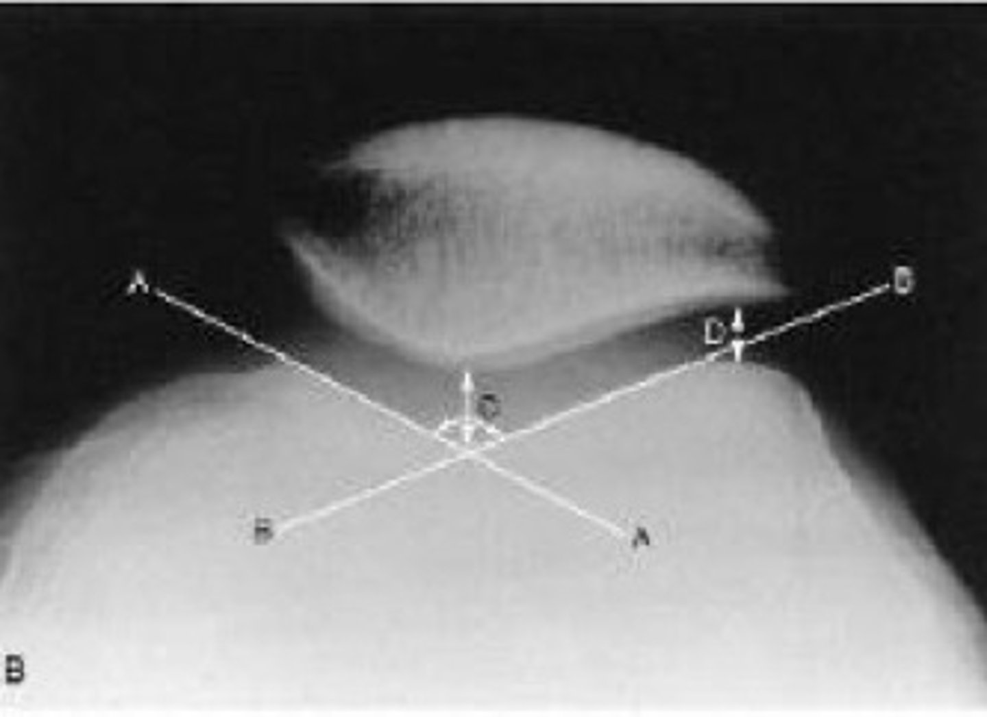 <p>What angle is this?</p>