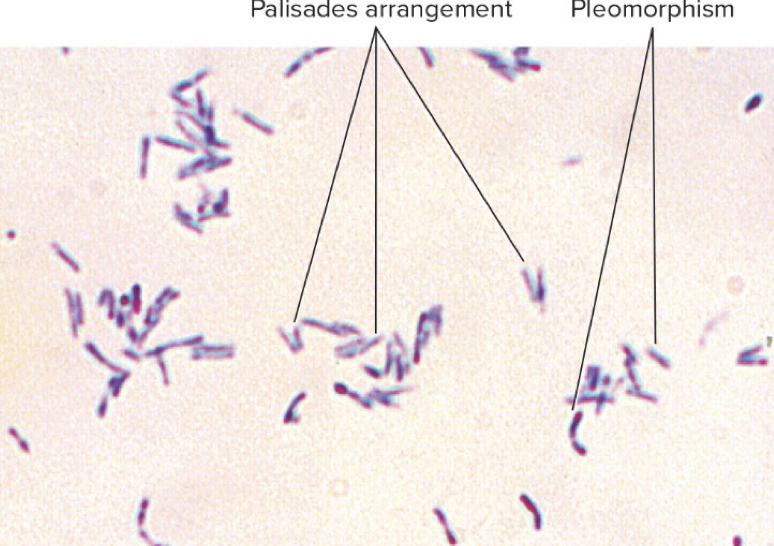 <p></p><ul><li><p>Arrangement of cells where cells look like picket fence</p></li><li><p>Vertical and next to each other</p></li></ul>