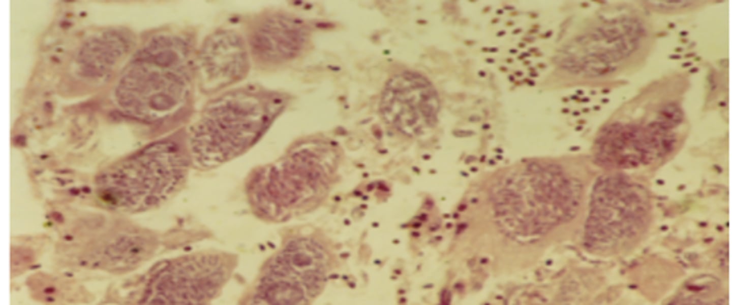 <p>Slide from a dead chicken - What parasite and life stage is this?</p>