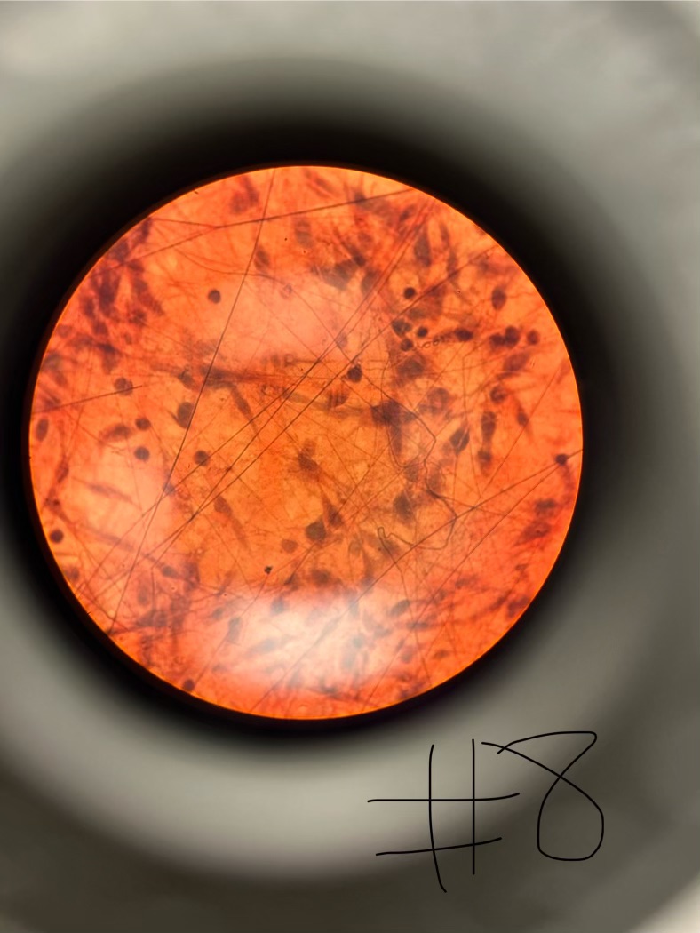 term image