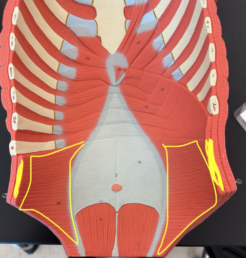 <p>What muscle is the yellow line indicating?</p>