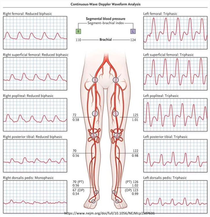 <ol><li><p>Which leg is normal? </p></li><li><p>Which leg is abnormal? </p></li></ol><p></p>