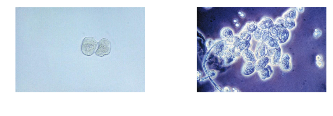 <p><span>Cuboidal, never round</span></p><p><span>At least one straight edge</span></p><p><span>Eccentric nucleus</span></p><p></p><p><span>Three or more cells in clump is renal</span></p><p><span>fragment; often large sheets</span></p><p></p><p><span>PCT and DCT not seen in clumps</span></p>