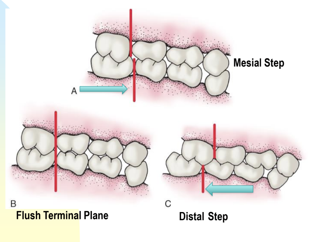 <ol><li><p>Mesial Step → primary mand 2M (distal surface) are situated more mesial than max molars </p><ul><li><p><strong>most common relationship</strong></p></li></ul></li><li><p>Flush Terimnal Plane → primary mand 2M even with each other on both arches (directly above one another) </p></li><li><p>Distal Step → primary mand 2M are more distal (posterior) than max molars </p></li></ol><p></p><p></p>