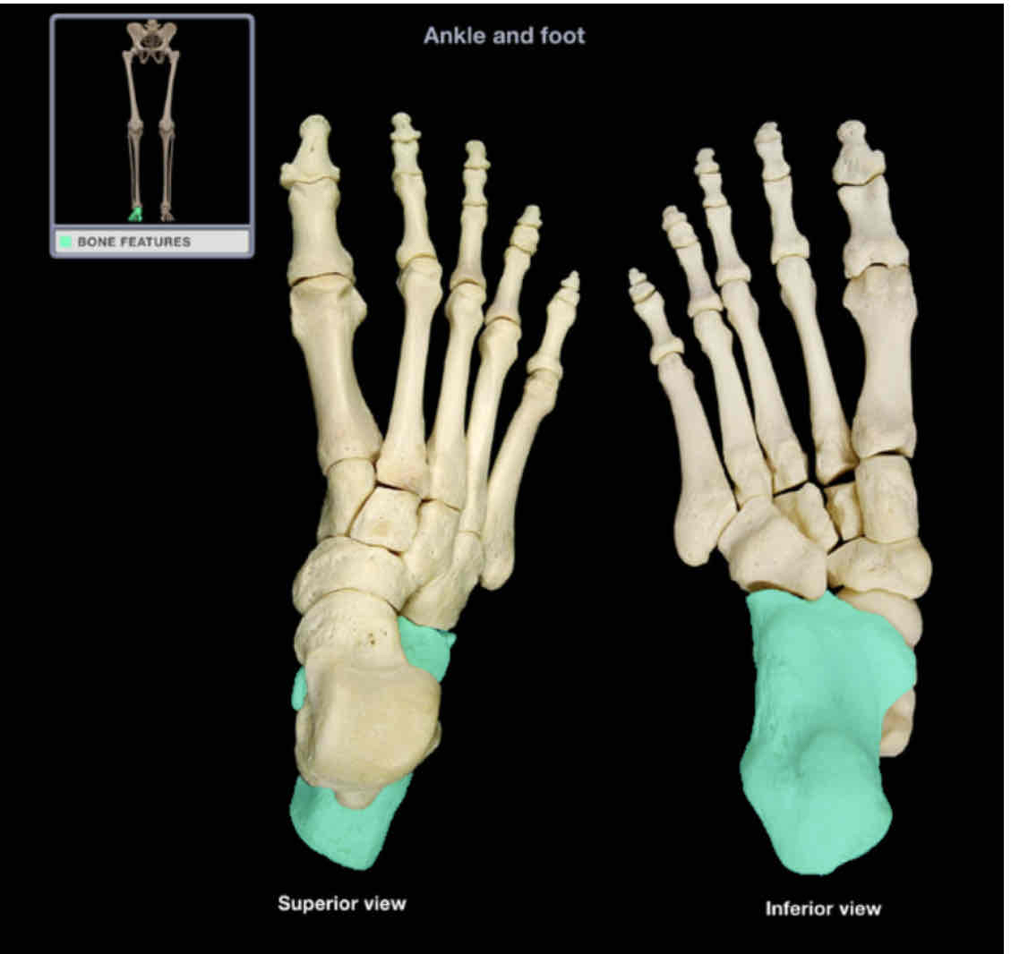 <p>Calcaneus</p>