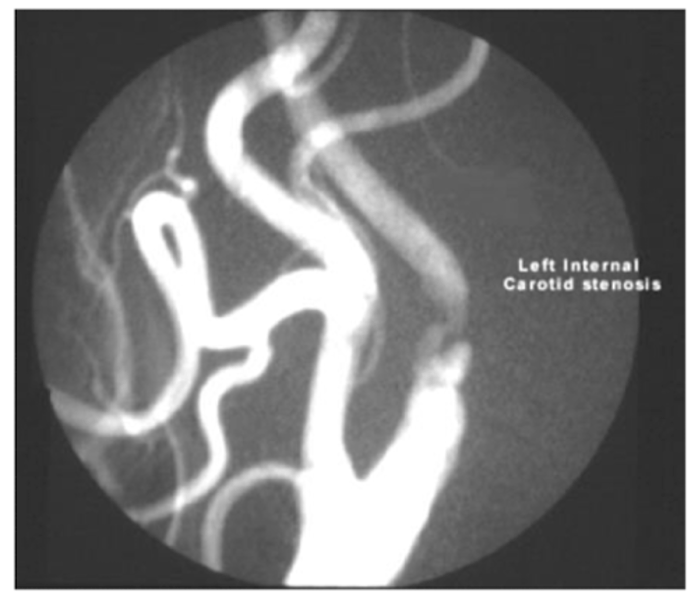 <p>angiography</p>