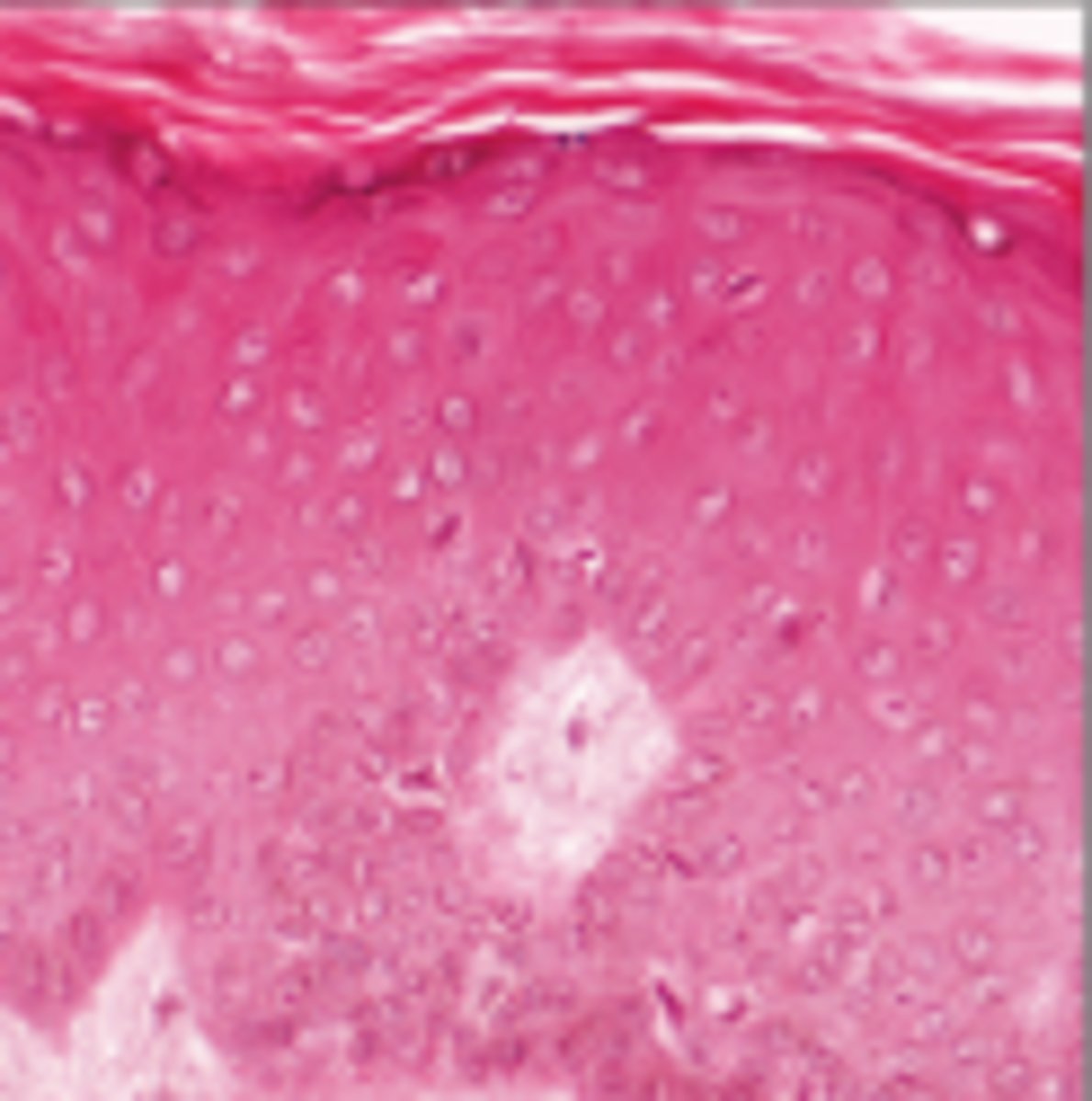<p>Found in epidermis</p>