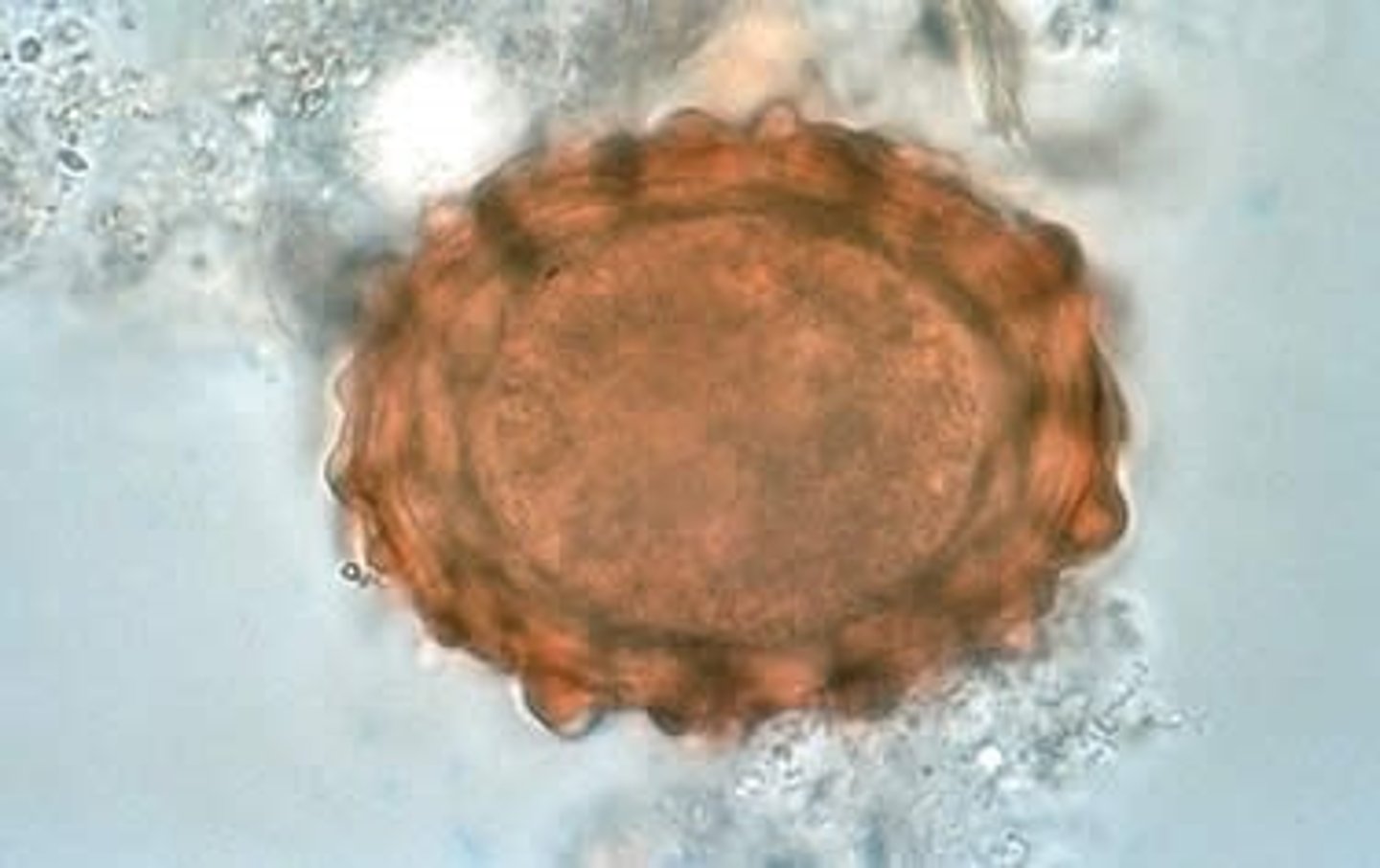 <p>This was found in a stool sample of a young scouring pig. What is it?</p>