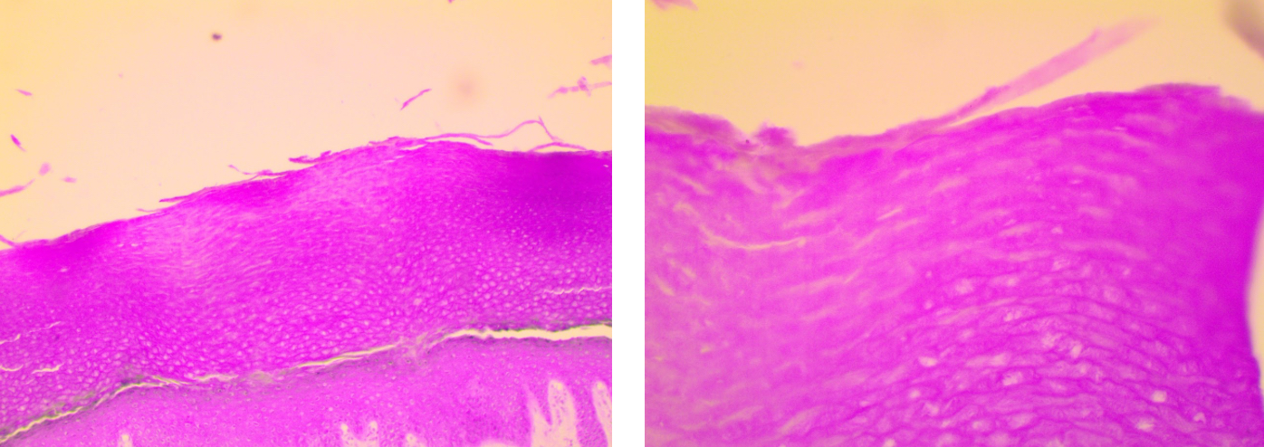 <p>Stratified squamous epithelium</p>
