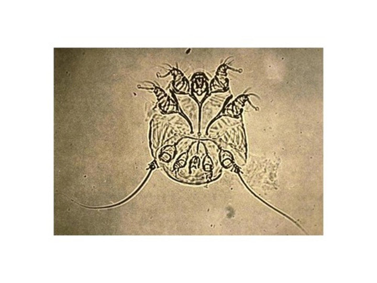 <p>Feline scabies</p>