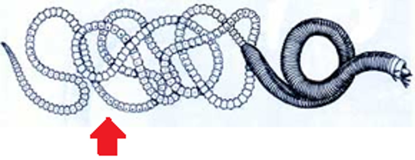 <p>- Parts of a worm specialized for sexual reproduction</p><p>- Swarming can occur when these are released</p>