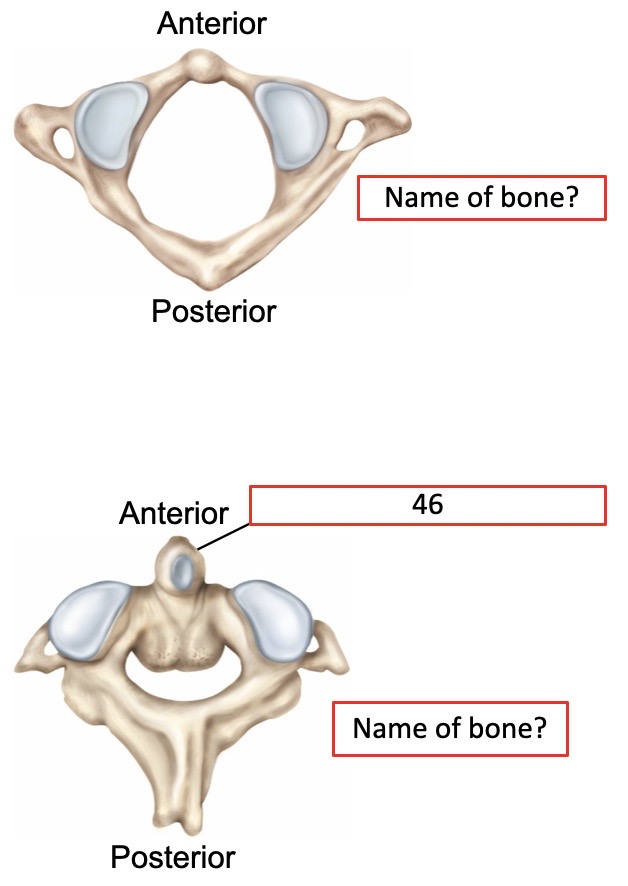 <p>Name of bone?</p>