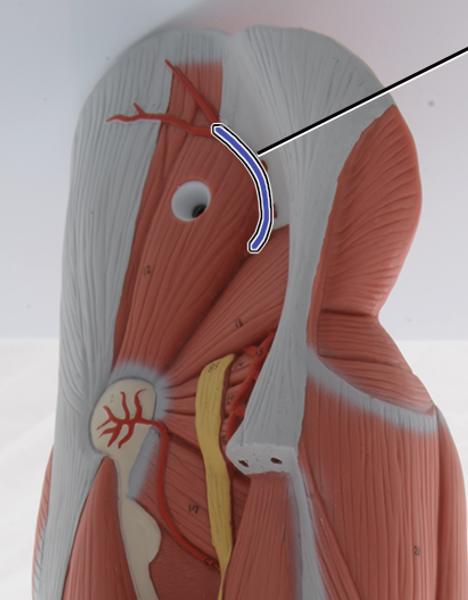 <p>supplies blood to glutes</p>