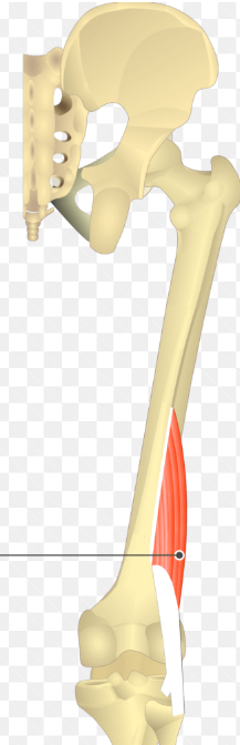 <p>name this muscle (specific)</p>