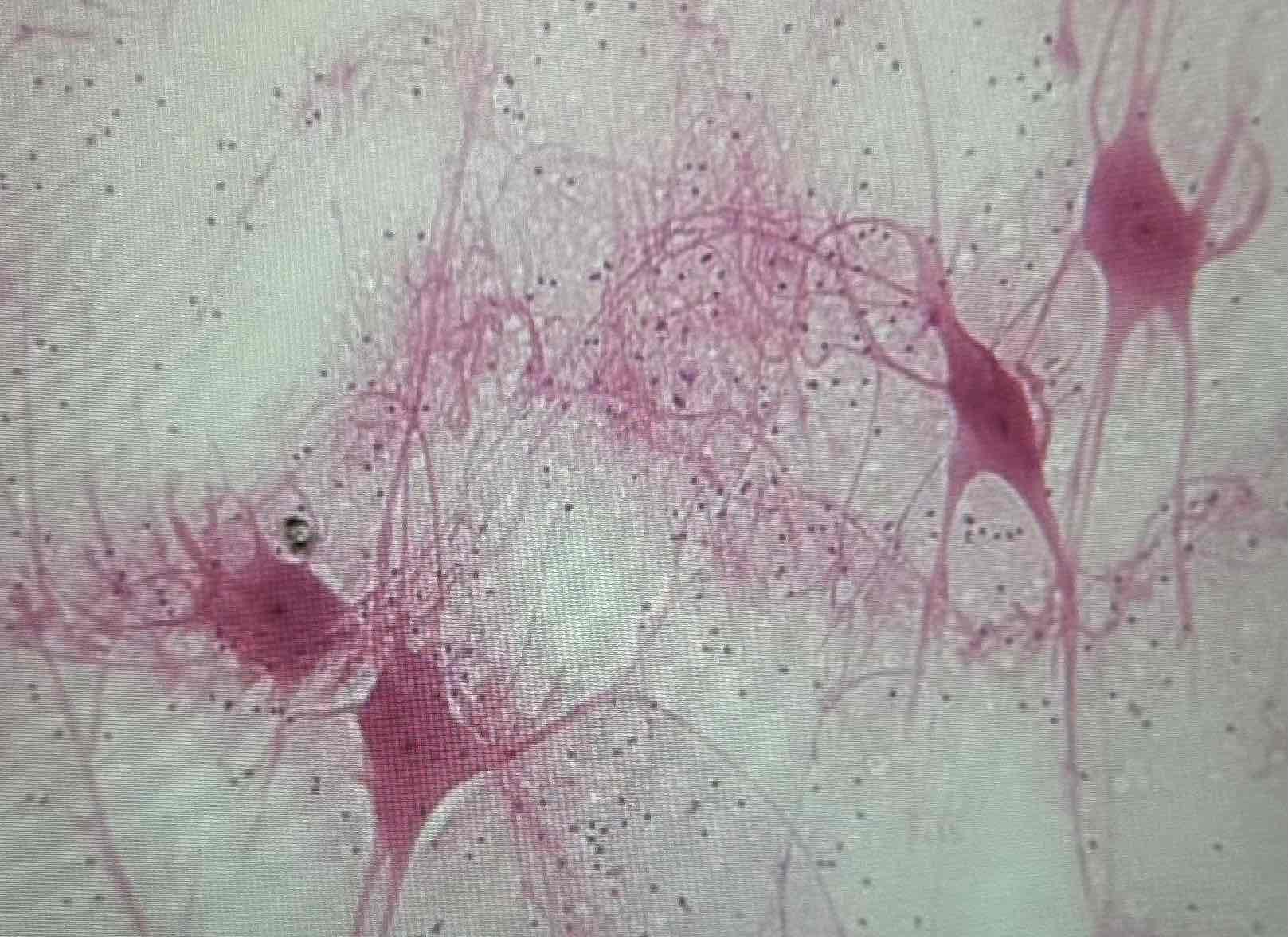 <p>Nervous</p>