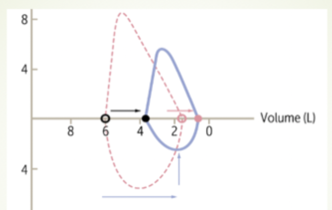 <p>How would you expect your FEV1/FVC to look with this flow loop</p>