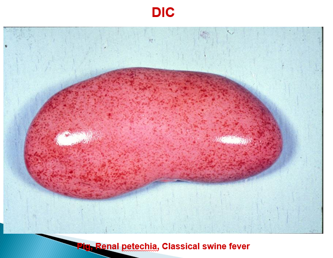 <p>Capillaries —&gt; swelling of endothelial cells, hyalinisation, complete obstruction </p><p>Arteries —&gt; thrombosis, necrosis </p>